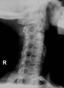 neck x-ray